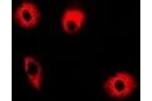 Immunofluorescent analysis of ABAT staining in A549 cells.