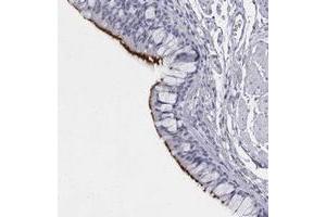 Immunohistochemical staining of human bronchus with C1orf114 polyclonal antibody  shows strong membranous positivity in respiratory epithelial cells. (C1orf114 anticorps)