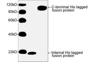 Image no. 2 for anti-His Tag (C-Term) antibody (ABIN294958) (His Tag anticorps  (C-Term))