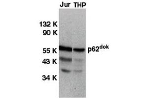 Western Blotting (WB) image for anti-Docking Protein 1, 62kDa (Downstream of tyrosine Kinase 1) (DOK1) (C-Term) antibody (ABIN1030364) (DOK1 anticorps  (C-Term))