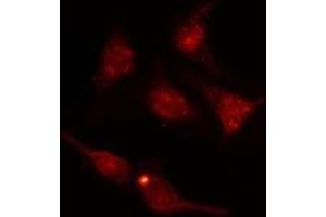 ABIN6277732 staining  HuvEc cells by IF/ICC. (NRF2 anticorps  (pSer40))