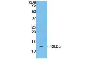 Detection of Recombinant CGa, Human using Polyclonal Antibody to Chorionic Gonadotropin Alpha Polypeptide (CGa)