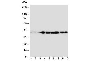 Western blot testing of CrkL antibody and rat samples 1: spleen (CrkL anticorps  (AA 286-303))