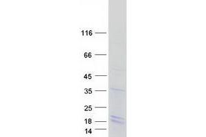 Validation with Western Blot