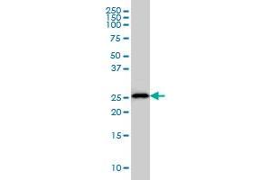 HLA-DMA monoclonal antibody (M01), clone 3F12-F11 Western Blot analysis of HLA-DMA expression in U-2 OS .