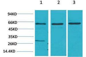 Western Blotting (WB) image for anti-V-Akt Murine Thymoma Viral Oncogene Homolog 2 (AKT2) antibody (ABIN3181588) (AKT2 anticorps)
