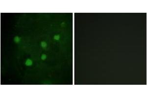 Immunofluorescence analysis of HuvEc cells, using BAF250B Antibody. (ARID1B anticorps  (AA 1371-1420))