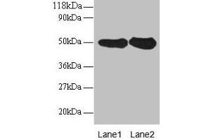Western blot All lanes: RPN1 antibody at 2 μg/mL Lane 1: EC109 whole cell lysate Lane 2: 293T whole cell lysate Secondary Goat polyclonal to rabbit IgG at 1/15000 dilution Predicted band size: 50 kDa Observed band size: 50 kDa (RPN1 anticorps  (AA 44-427))