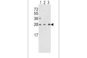 Western blot analysis of TPI1 Antibody (N-term) (ABIN389457 and ABIN2839524) in Y79(lane 1),CEM(lane 2) cell line and mouse brain tissue(lane 3) lysates (35 μg/lane). (TPI1 anticorps  (N-Term))
