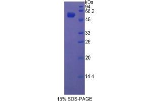 SDS-PAGE analysis of Rat Glucosidase beta , Acid Protein. (GBA Protéine)