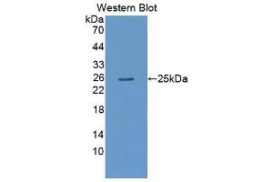 Western blot analysis of the recombinant protein. (DLG5 anticorps  (AA 1724-1917))