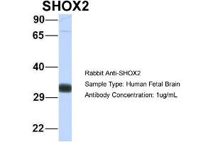 Host: Rabbit Target Name: SHOX2 Sample Type: Human Fetal Brain Antibody Dilution: 1. (SHOX2 anticorps  (N-Term))