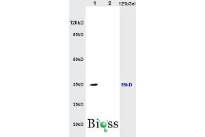L1 rat kidney lysates and L2 rat brain lysates lysates probed with Anti- IL-17RB Polyclonal Antibody, Unconjugated (ABIN747968) at 1:200 in 4 °C. (IL17 Receptor B anticorps  (AA 351-450))