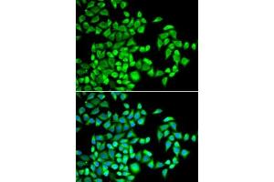 Immunofluorescence analysis of U2OS cells using  antibody (ABIN6131447, ABIN6136794, ABIN6136796 and ABIN6218313). (ALKBH1 anticorps  (AA 110-389))