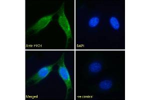 ABIN185667 Immunofluorescence analysis of paraformaldehyde fixed NIH3T3 cells, permeabilized with 0. (Patched 1 anticorps  (Internal Region))