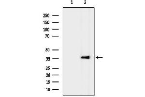 Western blot analysis of lysates from HepG2 cells(heat-shock treatment), using R Antibody.