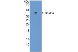 Detection of Recombinant NES, Rat using Polyclonal Antibody to Nestin (NES)