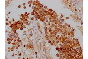 IHC image of ABIN7127486 diluted at 1:100 and staining in paraffin-embedded human testis tissue performed on a Leica BondTM system.