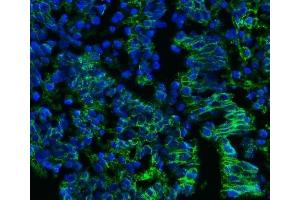 IF analysis of CD147/Emmprin using anti-CD147/Emmprin antibody (ABIN7599999). (CD147 anticorps  (AA 138-323))