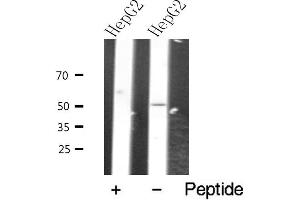 Western blot analysis of extracts from HepG2 cells, using VIPR2 antibody. (VIPR2 anticorps  (Internal Region))