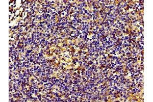 IHC image of ABIN7143827 diluted at 1:200 and staining in paraffin-embedded human tonsil tissue performed on a Leica BondTM system.