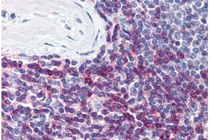 Human Spleen (formalin-fixed, paraffin-embedded) stained with CD7 antibody ABIN298827 at 5 ug/ml followed by biotinylated anti-mouse IgG secondary antibody ABIN481714, alkaline phosphatase-streptavidin and chromogen. (CD7 anticorps)