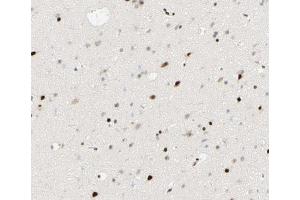 ABIN6267495 at 1/100 staining human brain tissue sections by IHC-P.
