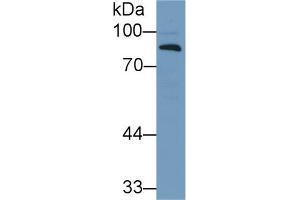 Western Blot; Sample: Human Lung lysate; Primary Ab: 1µg/ml Rabbit Anti-Human CFB Antibody Second Ab: 0. (Complement Factor B anticorps  (AA 270-388))