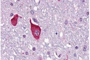 Immunohistochemical (Formalin/PFA-fixed paraffin-embedded sections) staining in human brain, neurons and glia with PTH2R polyclonal antibody . (PTH2R anticorps  (C-Term))