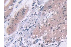 DAB staining on IHC-P; Samples: Human Stomach Tissue (ADAMTS10 anticorps  (AA 239-602))