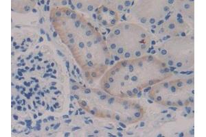 DAB staining on IHC-P; Samples: Mouse Kidney Tissue (NFKBIE anticorps  (AA 115-350))