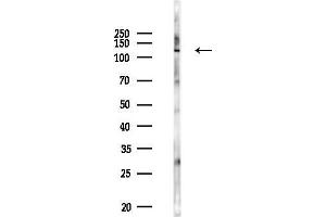 anti-Endosome/Lysosome-associated Apoptosis and Autophagy Regulator 1 (ELAPOR1) antibody
