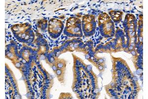 ABIN6257634 and ABIN6274771 at 1/100 staining Mouse colorectal tissue by IHC-P. (RPL18 anticorps  (C-Term))