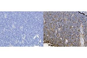 IHC analysis of CXCL12 using anti-CXCL12 antibody (ABIN6719467).