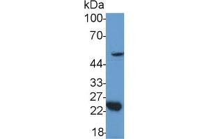 Detection of GDF11 in Mouse Cerebellum lysate using Polyclonal Antibody to Growth Differentiation Factor 11 (GDF11) (GDF11 anticorps  (AA 299-407))