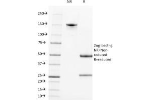 SDS-PAGE Analysis Purified CD21 / CR2 Mouse Monoclonal Antibody (CR2/1952). (CD21 anticorps  (AA 44-196))