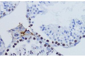 Immunohistochemistry of paraffin-embedded Mouse testis using TriMethyl-Histone H3-K9 Polyclonal Antibody at dilution of 1:200 (40x lens).