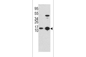 Western blot analysis of G8b (M1LC3B) Antibody (T6) 1802d in Y79 cell line lysates and mouse brain tissue lysates (35 μg/lane).