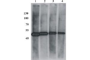 Western Blot testing of anti-BPV E2 monoclonal antibody (1E2). (Bovine Papilloma Virus 1 E2 (BPV-1 E2) (AA 182-190) anticorps)