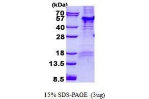 Figure annotation denotes ug of protein loaded and % gel used. (PARD6B Protéine)