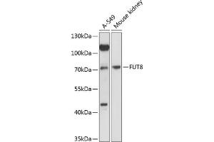 Western blot analysis of extracts of various cell lines, using FUT8 antibody (ABIN6132001, ABIN6140827, ABIN6140828 and ABIN6216749) at 1:3000 dilution. (FUT8 anticorps  (AA 376-575))