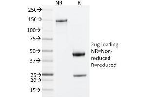 SDS-PAGE Analysis Purified ZAP70 Mouse Monoclonal Antibody (ZAP70/20535). (ZAP70 anticorps  (AA 247-382))
