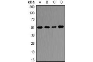 Western blot analysis of Ornithine Decarboxylase expression in Hela (A), THP1 (B), mouse kidney (C), mouse skeletal muscle (D) whole cell lysates. (ODC1 anticorps)