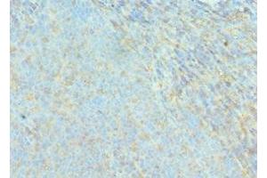 Immunohistochemistry of paraffin-embedded human tonsil tissue using ABIN7143076 at dilution of 1:100 (ACTR2 anticorps  (AA 1-160))