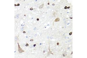 Immunohistochemistry of paraffin-embedded rat brain using IGFBP5 antibody (ABIN6130485, ABIN6142257, ABIN6142259 and ABIN6216084) at dilution of 1:100 (40x lens).