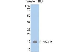 Detection of Recombinant SPTAN1, Human using Polyclonal Antibody to Alpha-Fodrin (SPTAN1) (SPTAN1 anticorps  (AA 289-408))