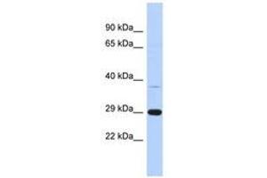 Image no. 1 for anti-Chromosome 1 Open Reading Frame 74 (C1ORF74) (AA 35-84) antibody (ABIN6741210) (C1ORF74 anticorps  (AA 35-84))