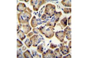 Formalin fixed and paraffin embedded Human pancreas tissue stained with RADIL Antibody (C-term) followed by peroxidase conjugation of the secondary antibody and DAB staining. (Radil anticorps  (C-Term))