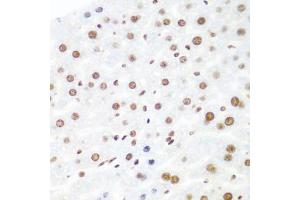 Immunohistochemistry of paraffin-embedded mouse liver using AGO2 antibody (ABIN5973585) at dilution of 1/100 (40x lens). (AGO2 anticorps)