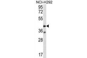 Western Blotting (WB) image for anti-Coagulation Factor II (thrombin) Receptor-Like 2 (F2RL2) antibody (ABIN2996634) (F2RL2 anticorps)